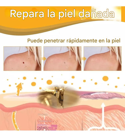 Recupera tu piel en pocos días | Spray Eliminador de Verrugas 🐝