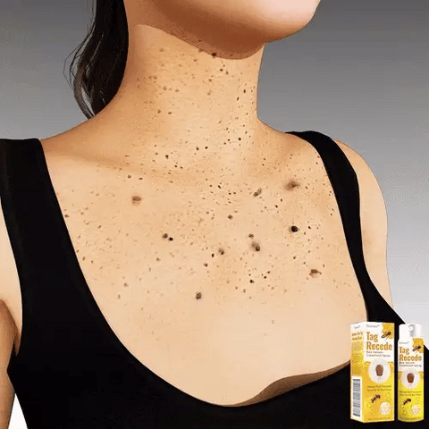 Recupera tu piel en pocos días | Spray Eliminador de Verrugas 🐝