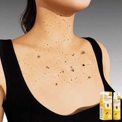 Recupera tu piel en pocos días | Spray Eliminador de Verrugas 🐝